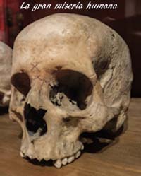  fotos, imagenes,  fotografias, dibujos,  fotografias, dibujos, graficos, la gran misewria humana, la miseria humana, la miseria humana poema, poesia la gran miseria humana